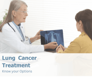 lung cancer treatment image